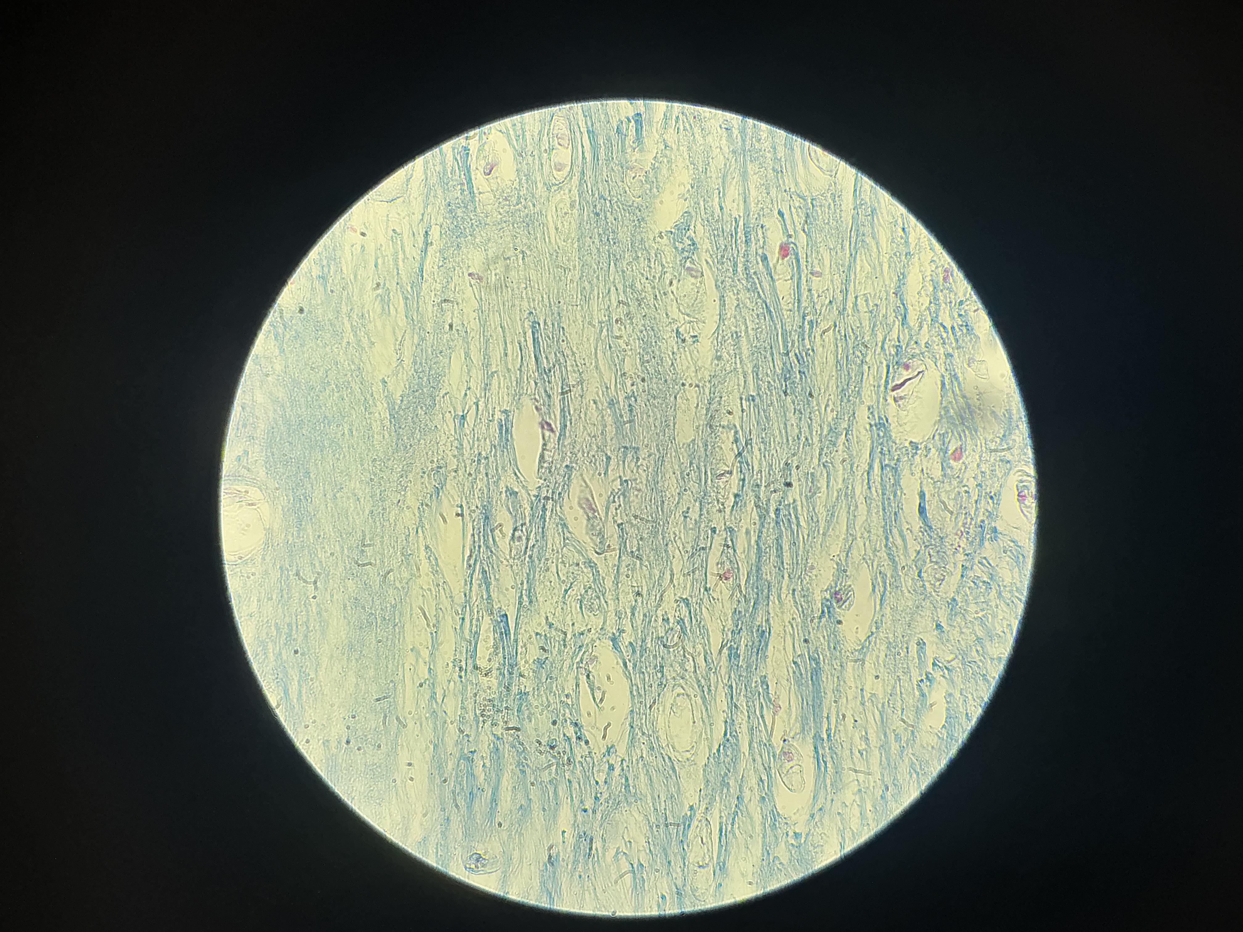 <p>what tissue is this?</p>