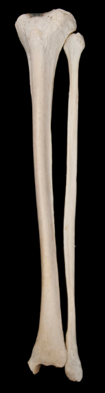 <p><span>Of these two bones, what is the medial bone called?</span></p>