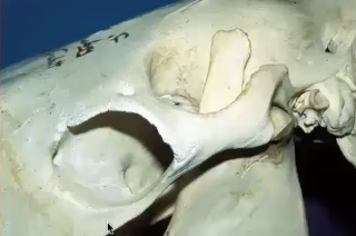 <p>Complete bony rim eye socket</p><p>More trauma to break</p>