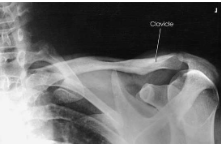 <p>What type of projection, position and anatomy is this?</p>