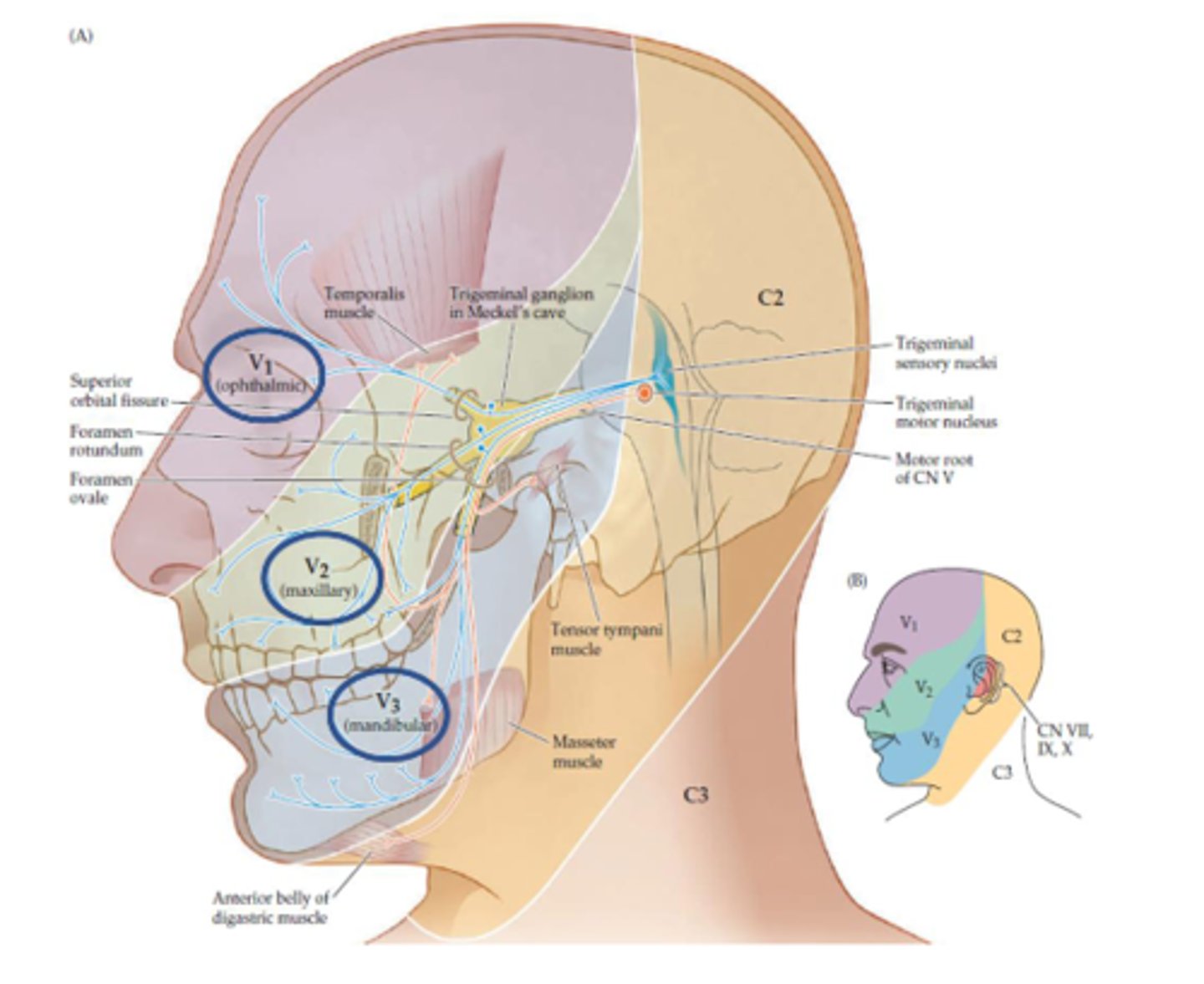 <p>- Ipsilateral sensory loss</p><p>- Synapses in trigeminal nucleus THEN crosses over</p>