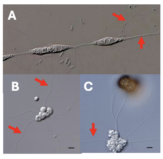 <ul><li><p><strong><em>Labyrinthulomycota</em></strong> (A) = slime nets</p></li><li><p><strong><em>Thraustochytridiomycota</em></strong> (B-C) = saprotrophic decomposers</p></li></ul><p></p>