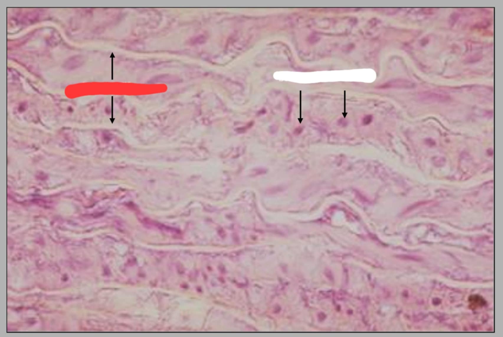 <p>Name of this slide and state the parts.</p>