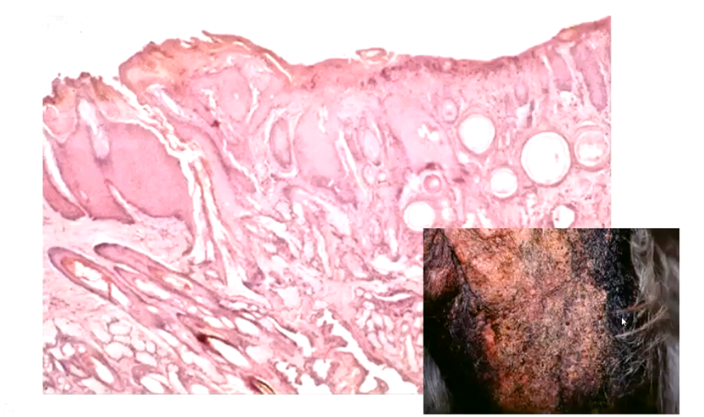 <ul><li><p>Hyperkeratosis, hyperplasia and dysplasia</p></li><li><p>Chronic inflammation, presence of cysts</p></li></ul><p></p>