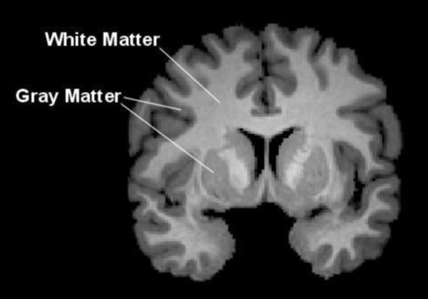 <p>- 2/3cm sheet of <strong>gray matter</strong> (unmyelinated cells) outermost layer of the brain, consists of neurons and cell body, 75% of area lies within folds maximizing brain space </p><p><strong>- white matter</strong> militated axons linking neurons to different areas of the brain</p><p>- Provide landmarks for dividing cortex into major areas </p><p></p><p>Connection to methodology: </p><p>- <strong>fMRI</strong> can image cerebral cortex as well as deeper subcortical  areas: amygdala (conditioned fear)</p><p>- <strong>EEG</strong> captures electrical signalling from neurons in the cerebral cortex, outermost layer of the brain </p>