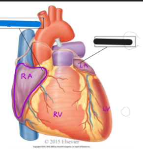 <p>What is the black structure?</p>