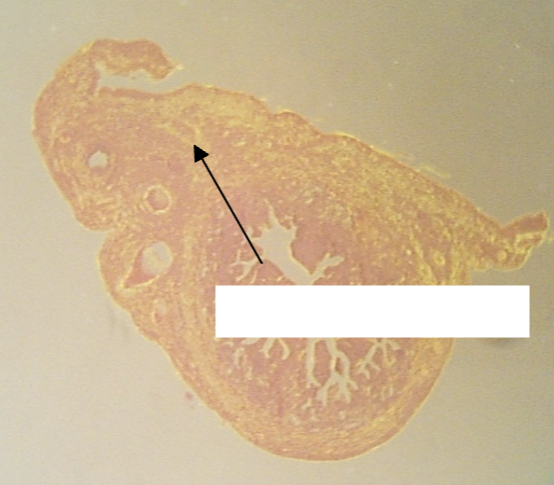 <p>What is the structure being indicated by the arrow?</p>