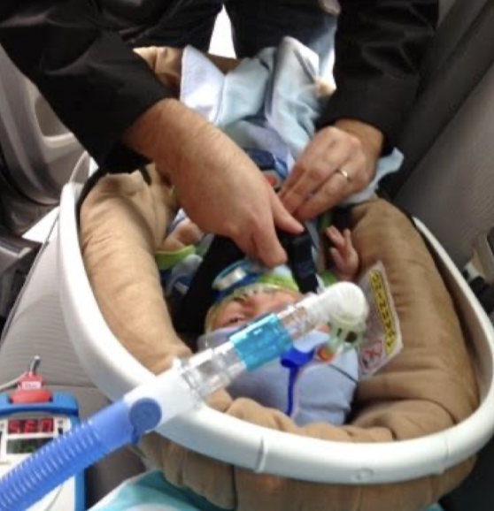 <p>- can use <strong><em><u>pool noodles</u></em></strong></p><p>- <strong><em><u>car bed</u></em></strong> padded around </p><p>- safest in <strong><em><u>rear facing car seat</u></em></strong>, for <strong><em><u>as long as possible</u></em></strong> w/ <strong><em><u>5-point harness</u></em></strong></p><ul><li><p>may need <strong><em><u>extra padding</u></em></strong></p></li></ul>