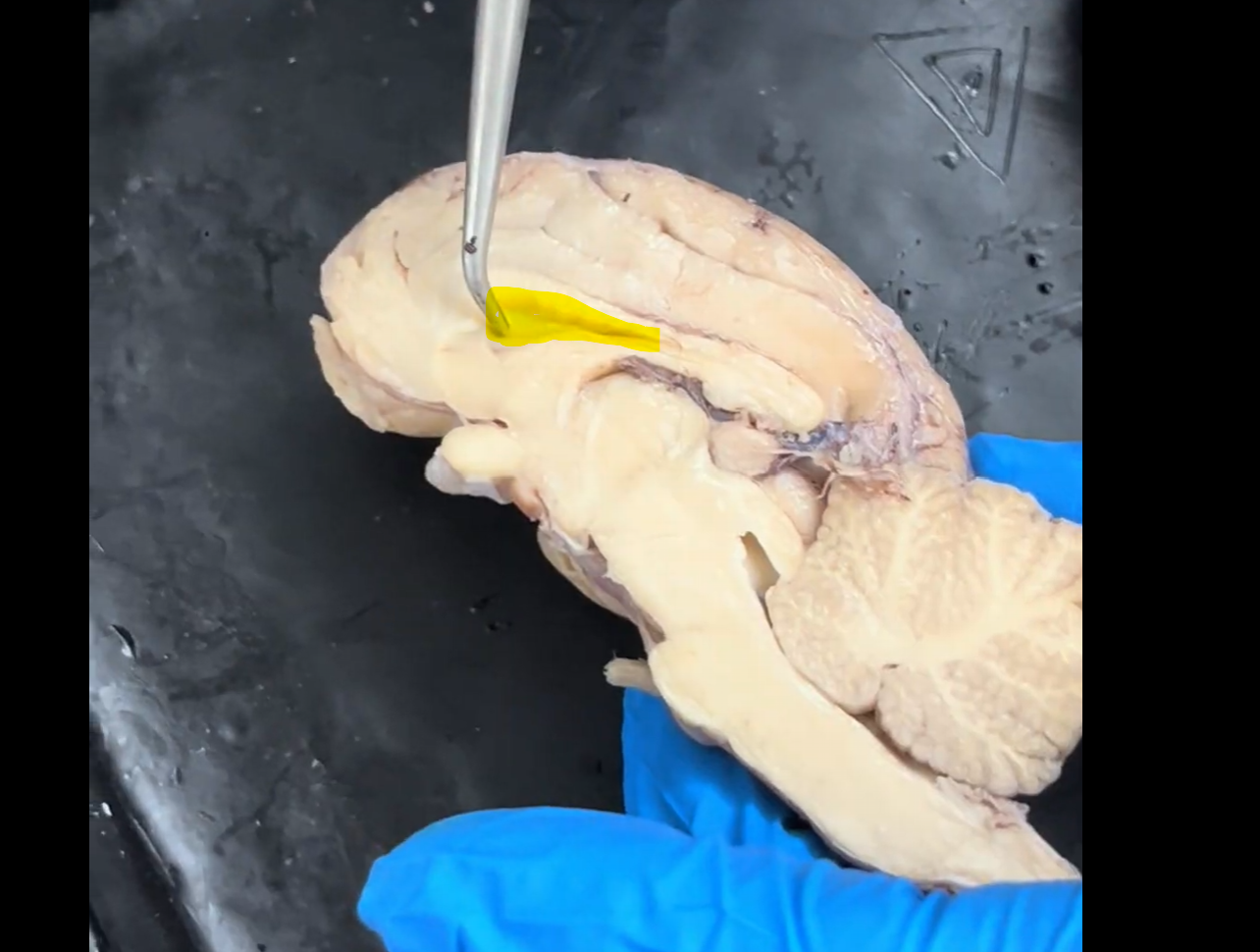 <p>Name the highlighted <strong>membrane</strong>.</p>