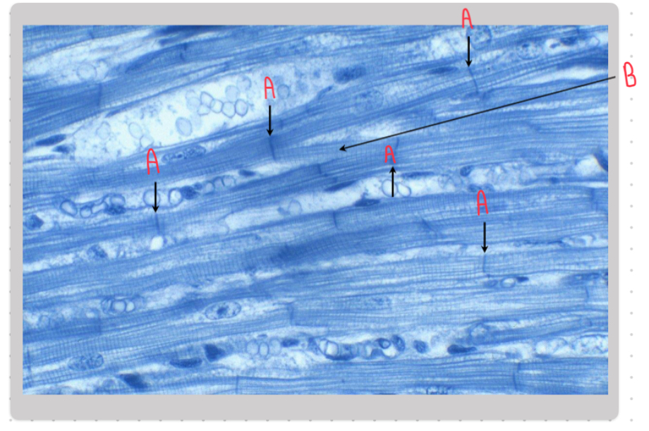 <p>Name the structures labeled B in this image:</p>