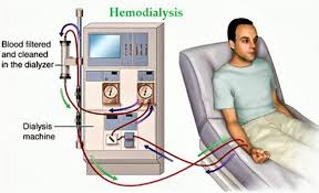 <ul><li><p>functions like normal kidneys</p></li><li><p>adverse effects:</p></li></ul><p><span style="color: #000000"> Hypotension</span><span style="color: #000000"><br></span><span style="color: #000000"> Dysrhythmias</span><span style="color: #000000"><br></span><span style="color: #000000"> Muscle cramps</span><span style="color: #000000"><br></span><span style="color: #000000"> Nausea and vomiting</span><span style="color: #000000"><br></span><span style="color: #000000"> Hemorrhage from access site</span><span style="color: #000000"><br></span><span style="color: #000000"> Infection at access site</span></p>