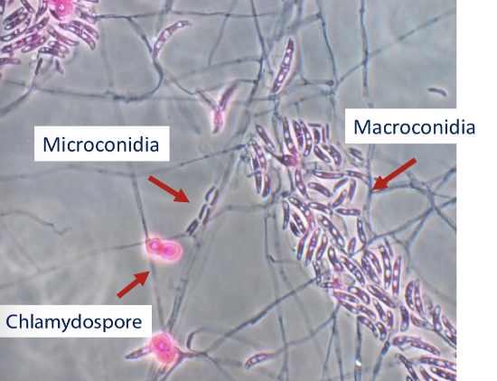 <p>A species of Fusarium with white to cream cottony colonies and long conidiophores. May contain Chlamydosmore </p>