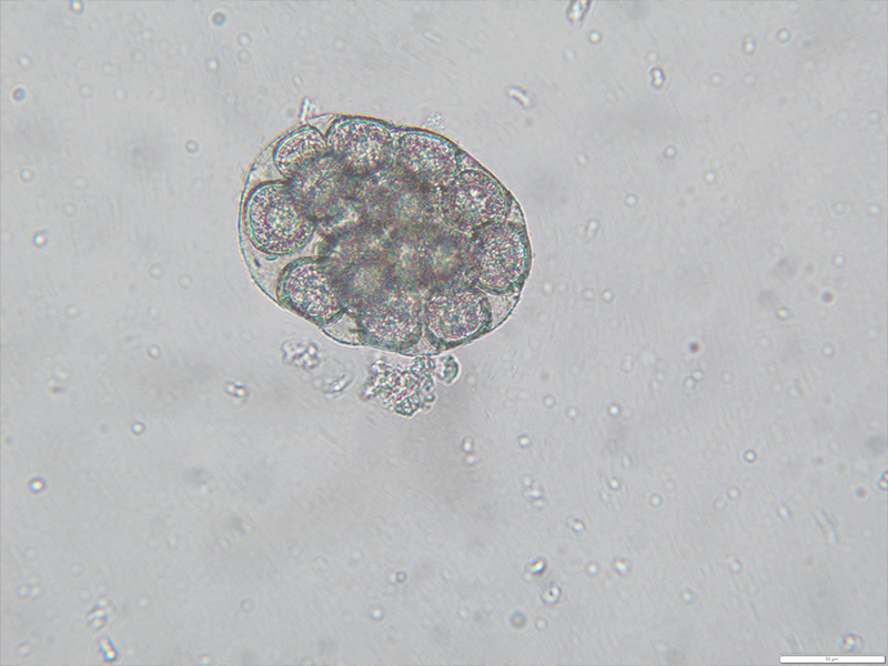<p>in human</p><p>cat, dog stool, intestinal discomfort, proglottids crawl from anus</p><p>Worldwide (human infections in Europe, China, Pacific Asia, America</p>