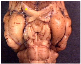 <p>Name the part of the brain marked by the yellow dot.</p>