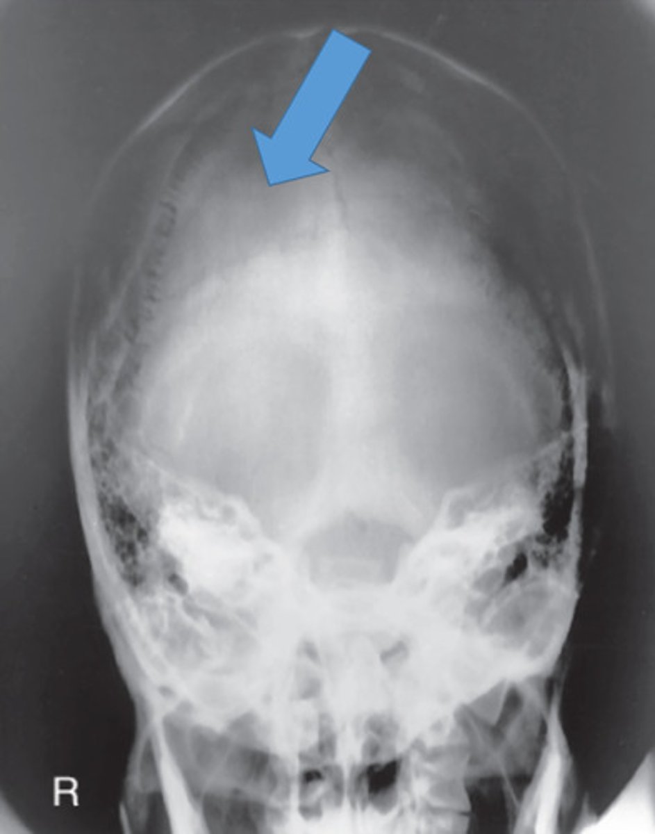 <p>Which position is this?</p>