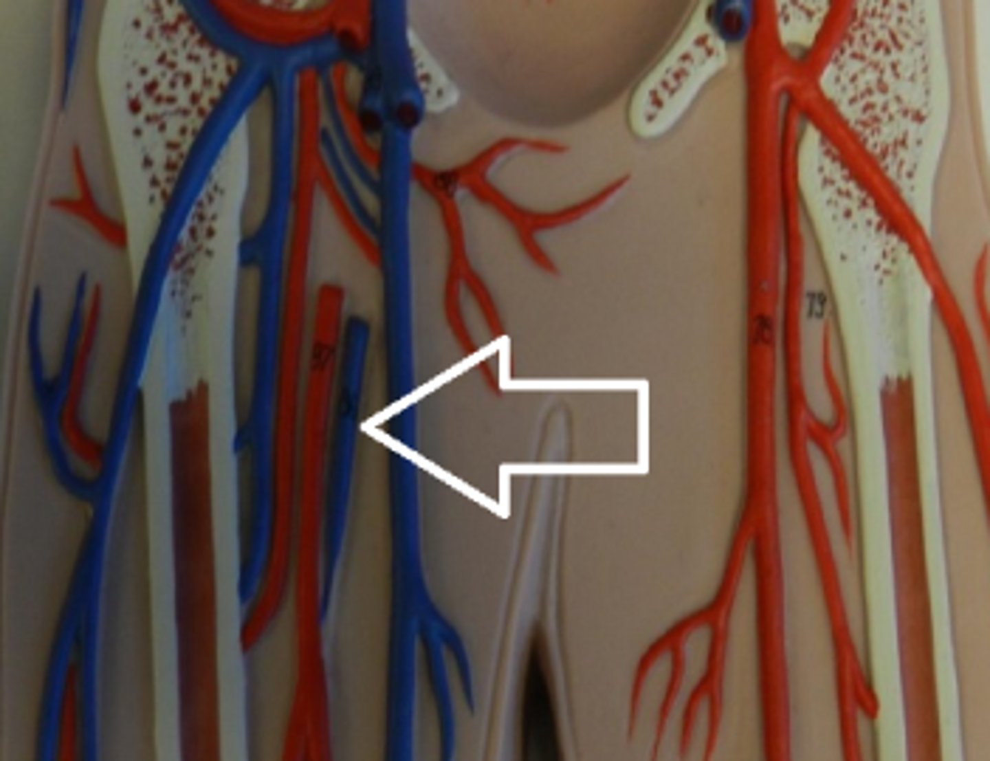 <p>Name the blood vessel.</p>