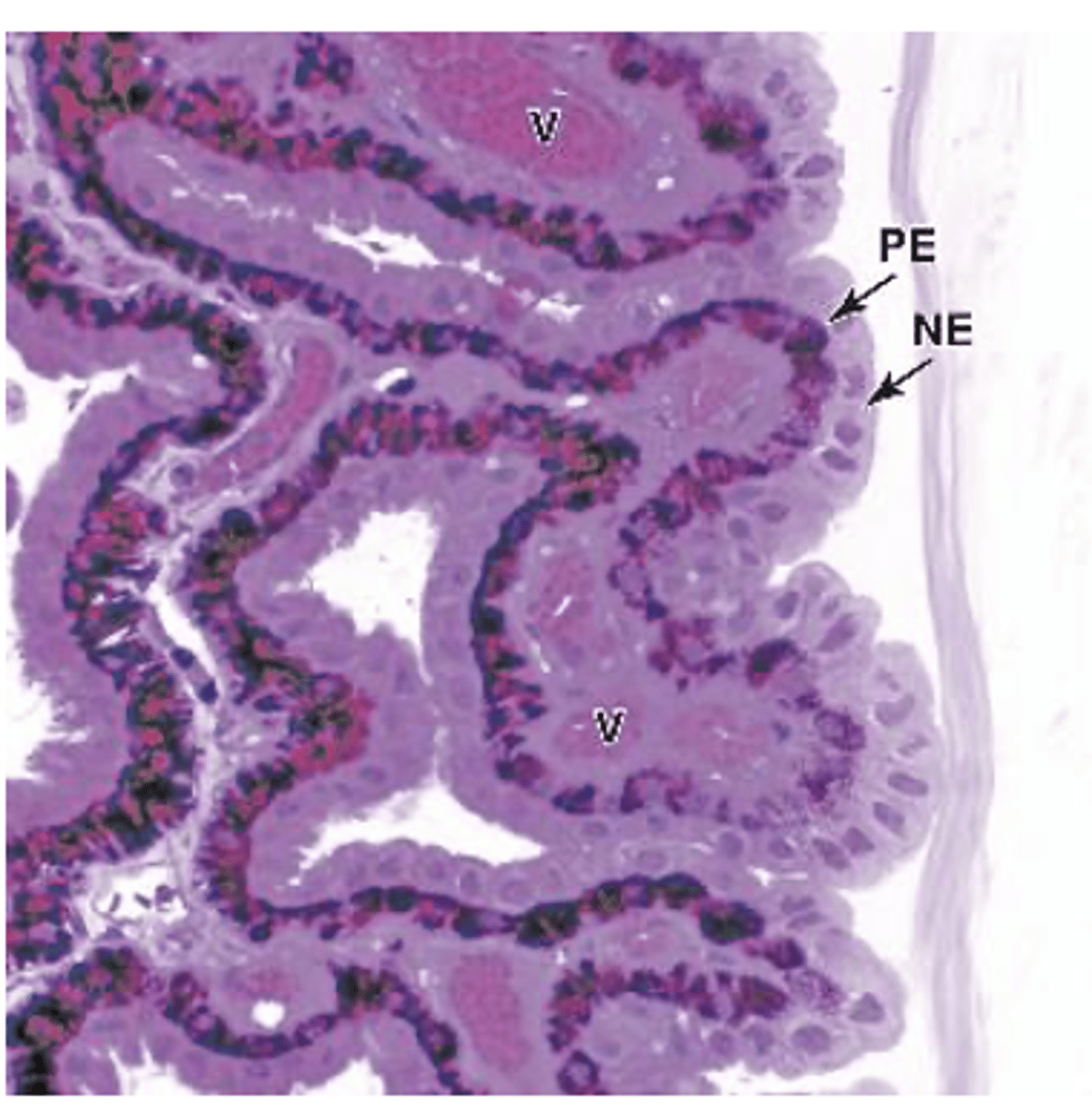 <p>What type of epithelium covers the ciliary processes?***</p>