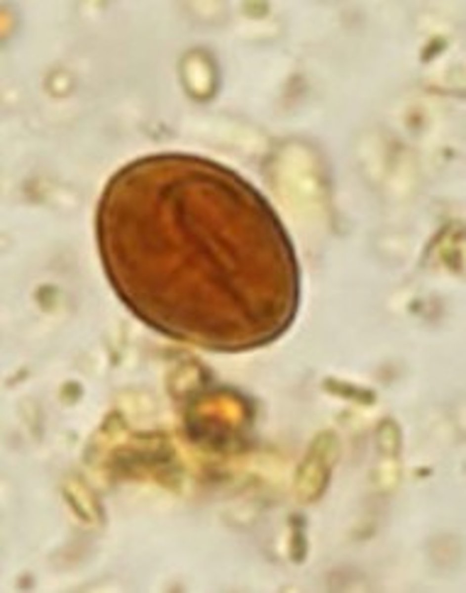 <p>Identify the parasite</p>