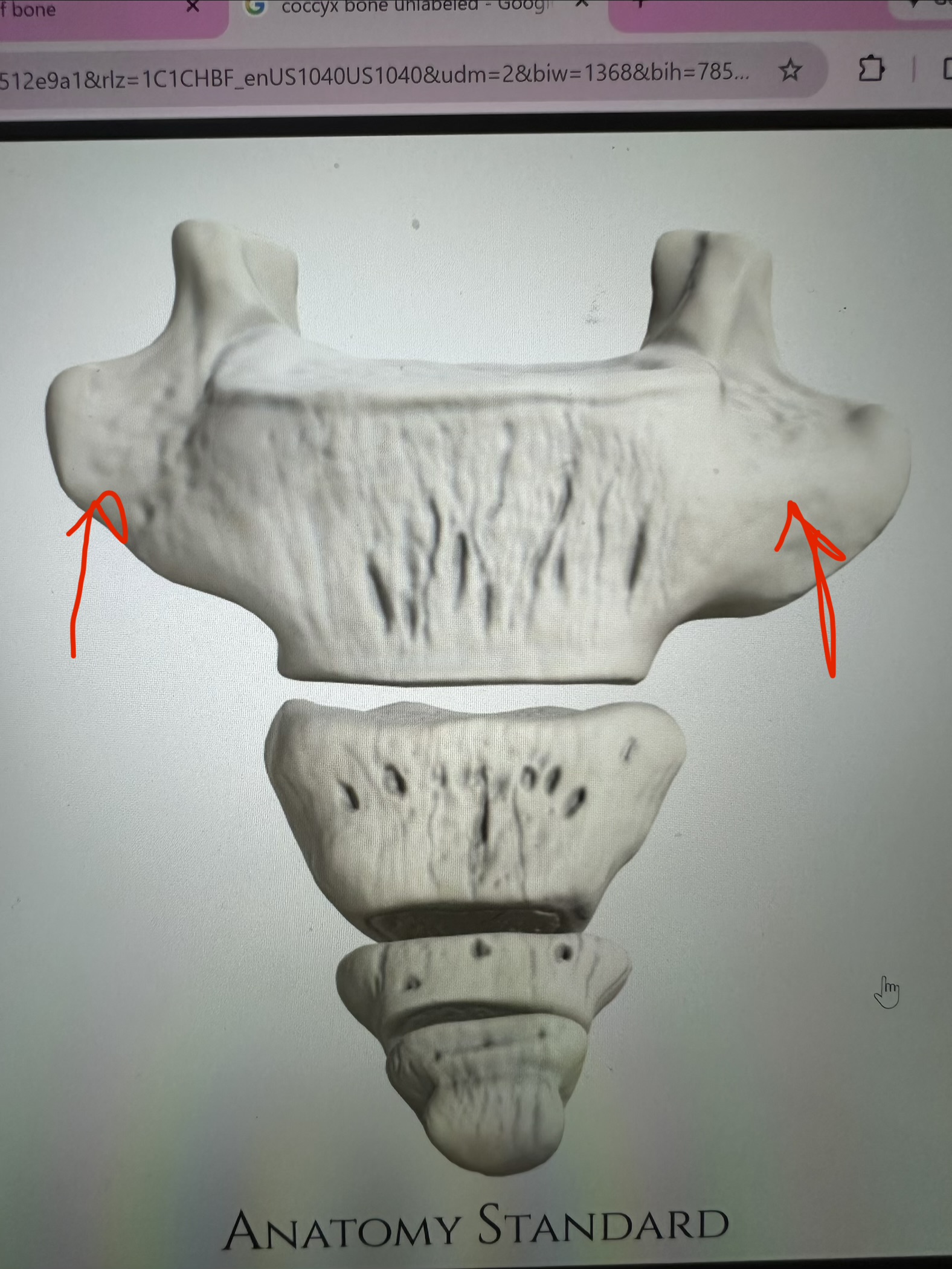 <p>coccyx, horizontal projections</p>