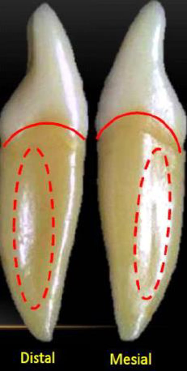 <p>what tooth is this?</p>