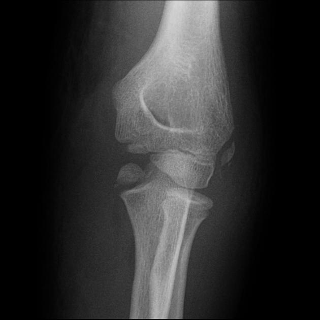 <p>Describe the abnormality demonstrated.</p>