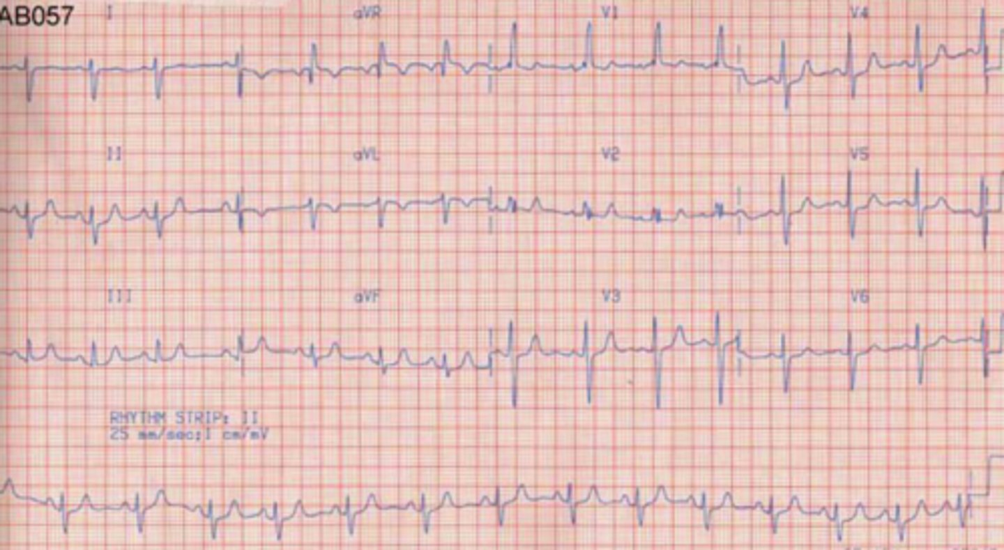 <p>What are the findings</p>