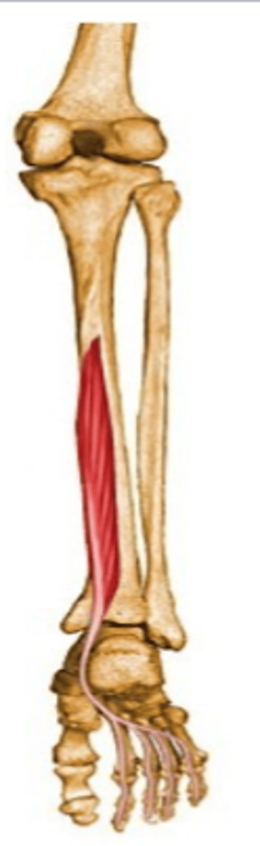 <p>what is this muscle?</p>