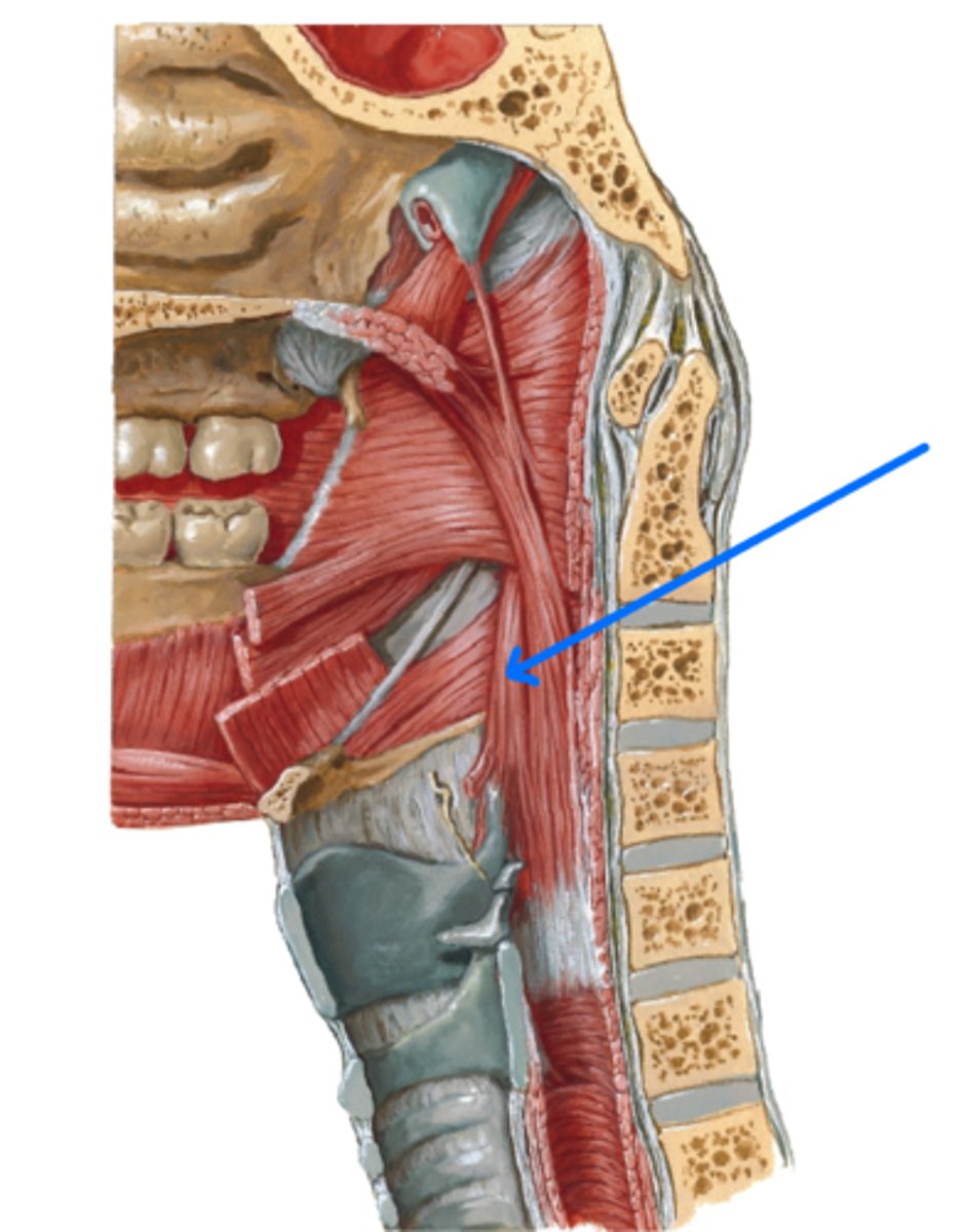 <p>What is this muscle?</p>
