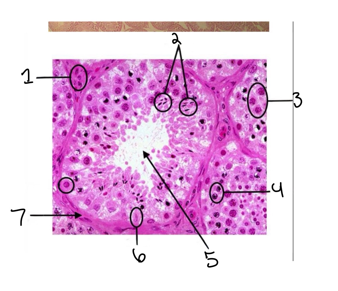 <p>Spermatocytes </p>