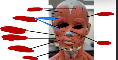 <p>What muscle is this?</p>