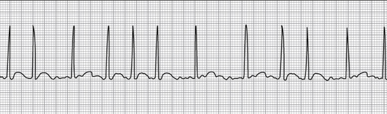 <p>what rhythm is this</p>