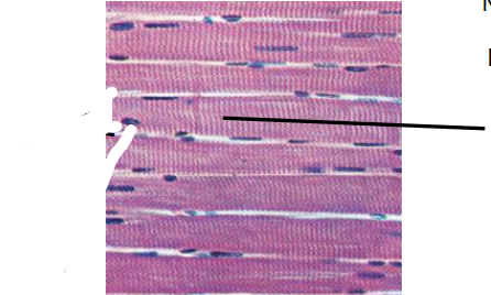 <p>What type of skeletal muscle tissue is this?</p>