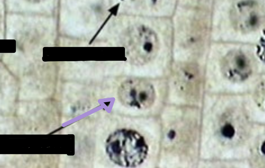 <p>what stage of cell division is this? </p>