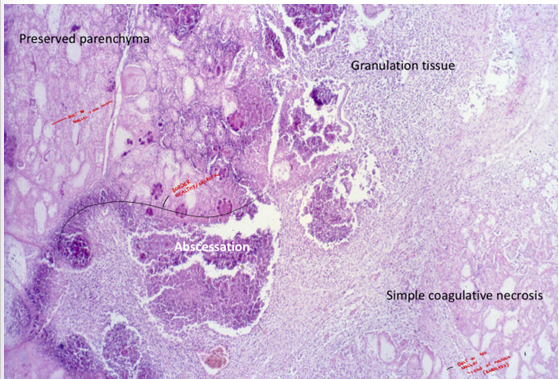 <p>this is?</p><img src="https://knowt-user-attachments.s3.amazonaws.com/cf3e981a-d17f-4106-b9d4-0372e92c9ba5.png" data-width="100%" data-align="center"><p></p>