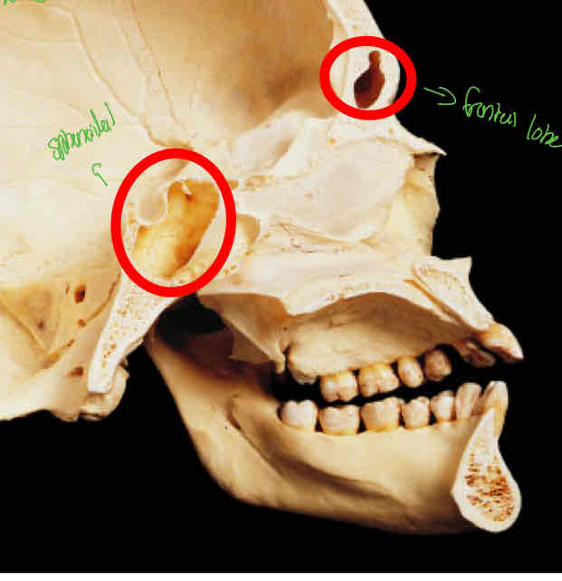 <p>Identify this </p>