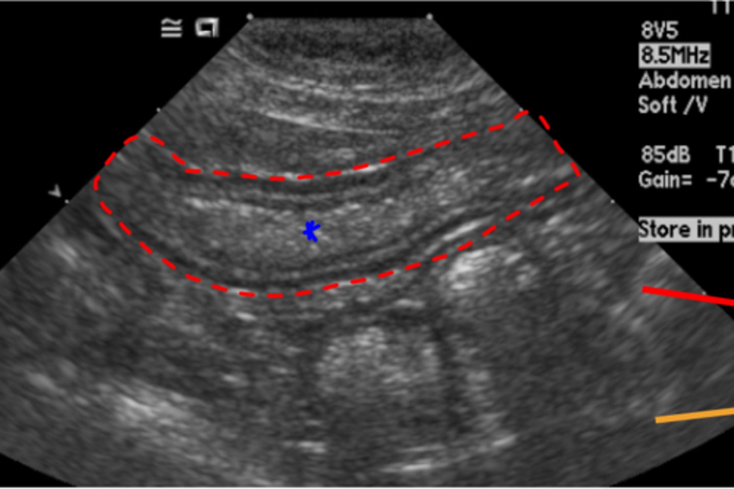 <p>what view is this? what is in the intestines?</p>