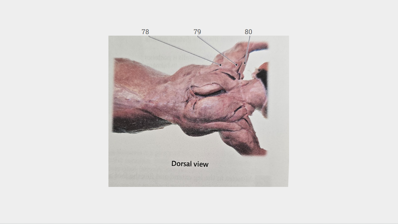 <p>What is labeled 79?</p>