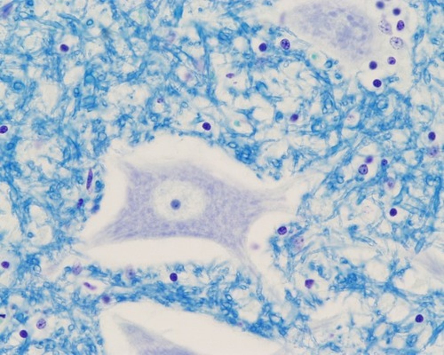 <p>also known as "glia," support cells that provide neurons with structure, nutrients, insulation, and waste removal; they cannot even transmit impulses</p><p>Picture: nuroglia appear to be small, dark dots</p>