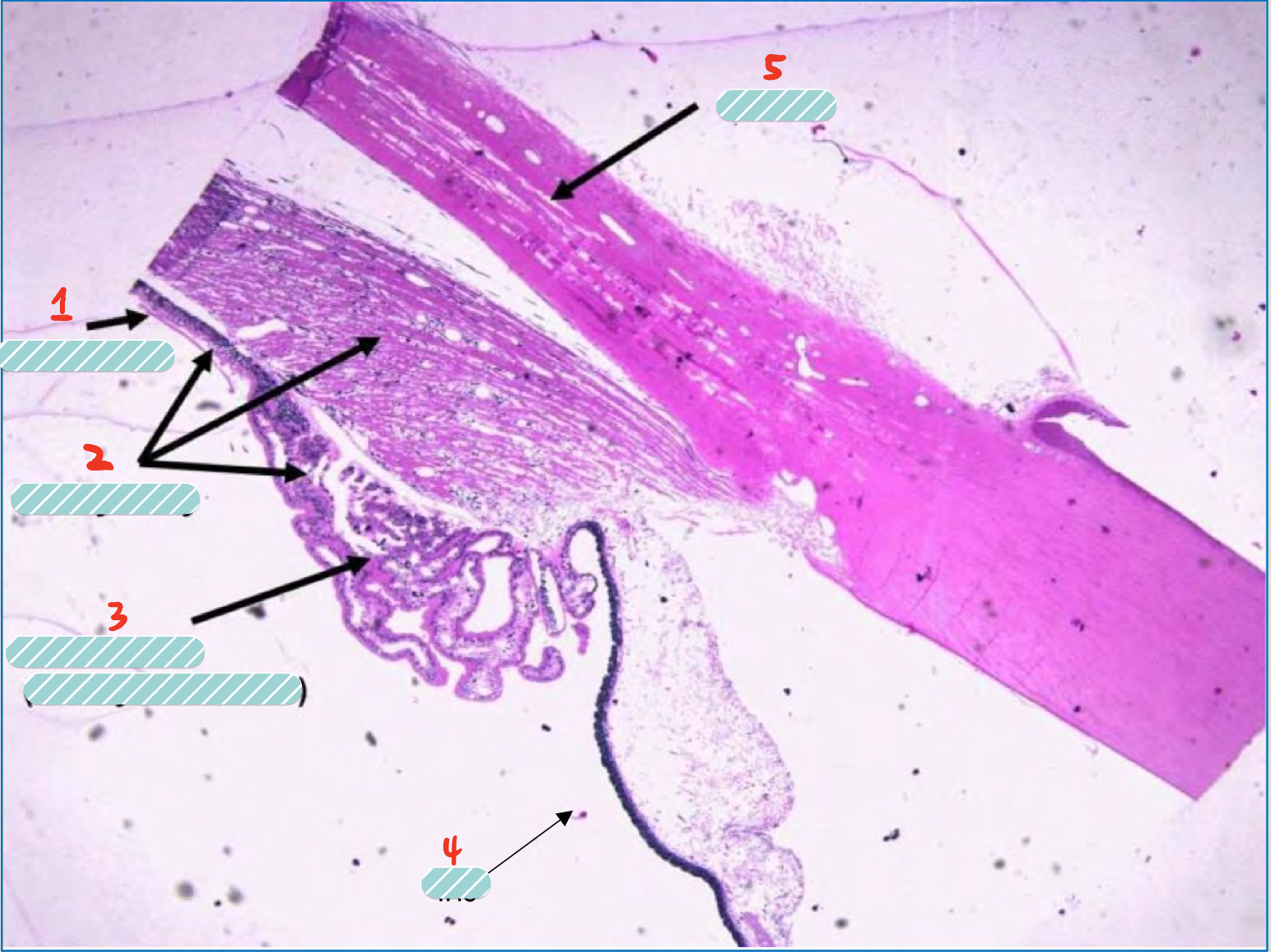 <p>name the structures of the iridocorneal angle</p>