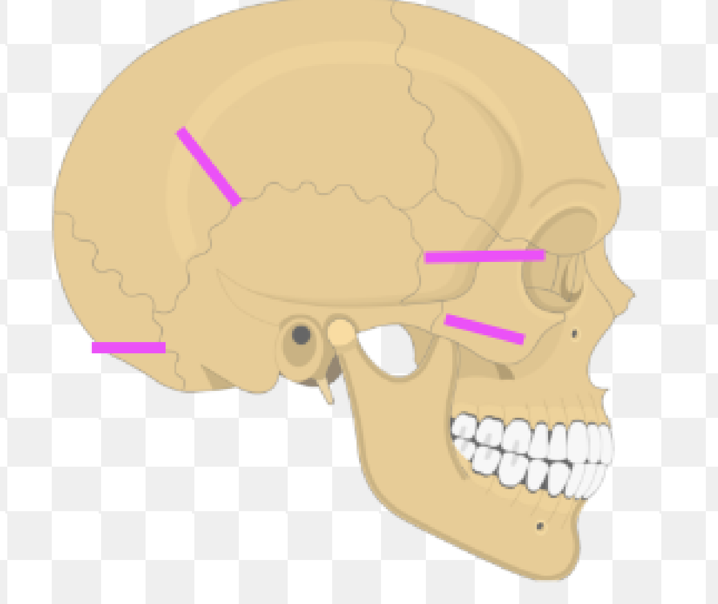 <p>What bone marking is this?</p>