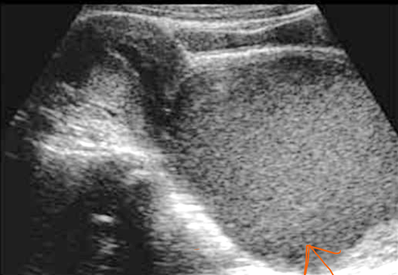 <p>What is this condition called?</p>