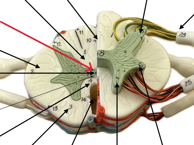 <p>Which gray commissure of the spinal cord is:</p><ul><li><p>Gray and on posterior side</p></li><li><p>Posterior to the central canal </p></li></ul><p></p>