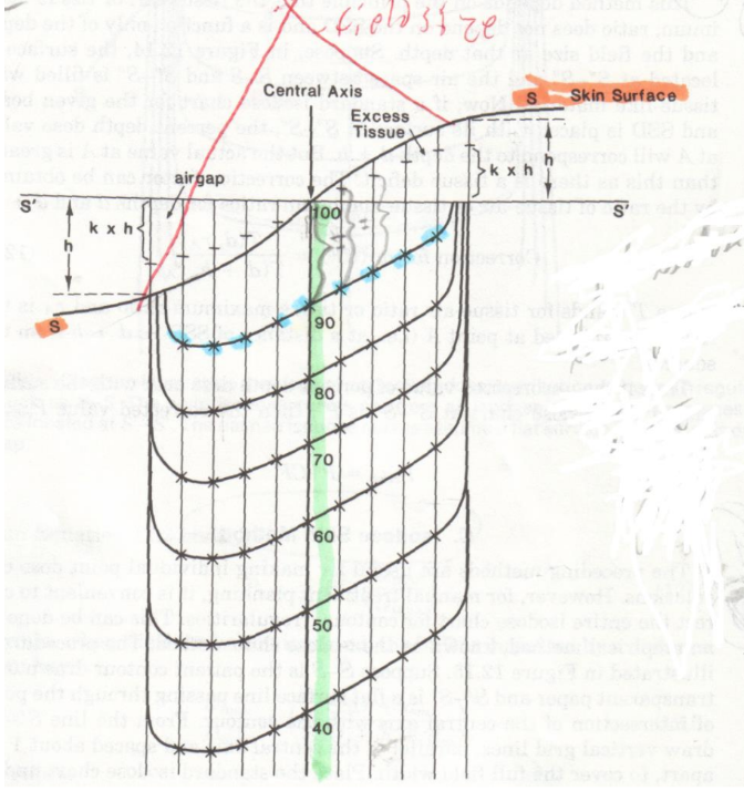 <p>The beam doesn’t exactly follow the angle of the skin surface, depending on the Energy of the beam that you use.</p><p>E.g. If you have a 45 degree tilt in the skin surface, the angle of the isodose curves would only be 2/3rd of that</p>
