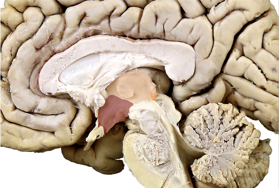 <p><strong>what are the regions of the diencephalon?</strong></p>