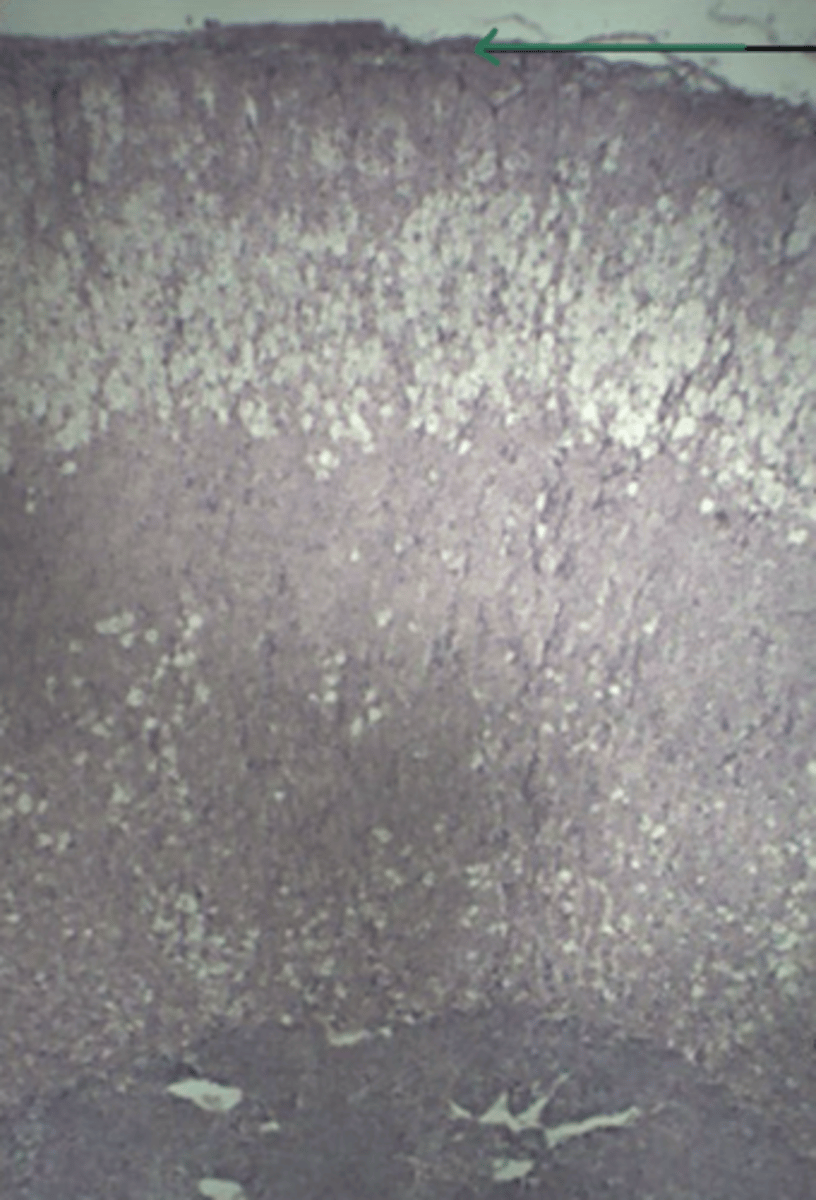 <p>gland and structure</p>