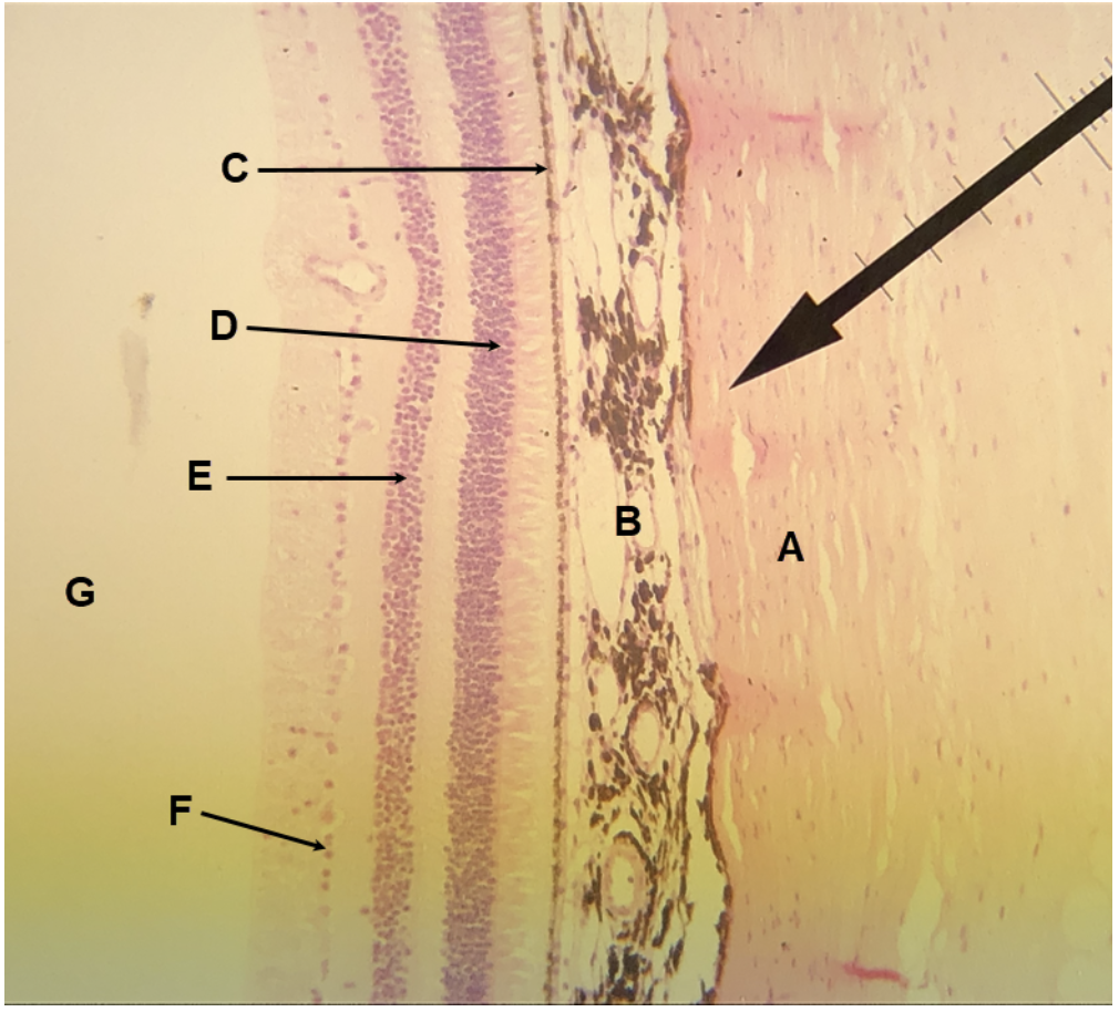 <p><span><span>In the image above, identify structures/parts of the eye wall A and B, layers/sublayers C-F, and space G.&nbsp; For H, name the structure/part of the eye wall that consists of C-F together.</span></span></p>