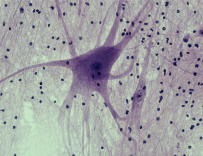 <p>Нервова тканина</p>