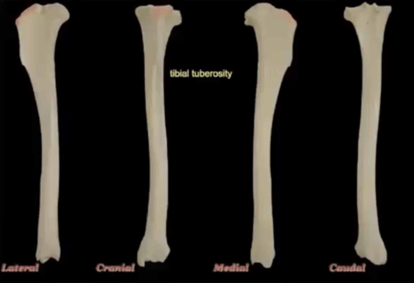 <p>attachment of patellar ligament; large bump on the cranial aspect</p>