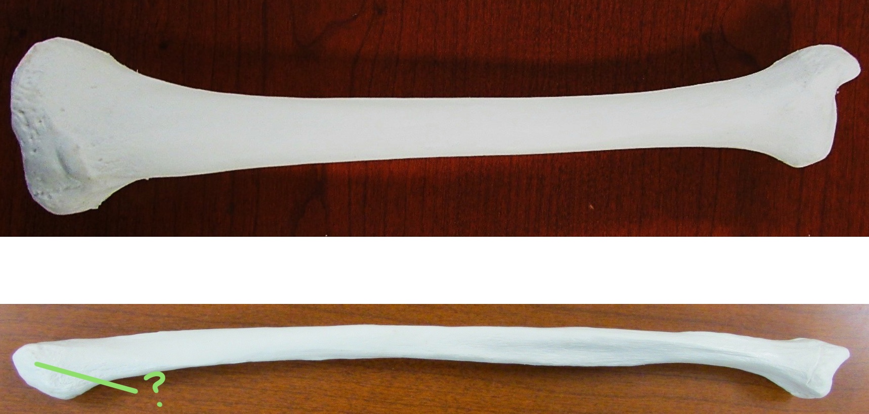 <p>Determine the part of the Fibula highlighted</p>