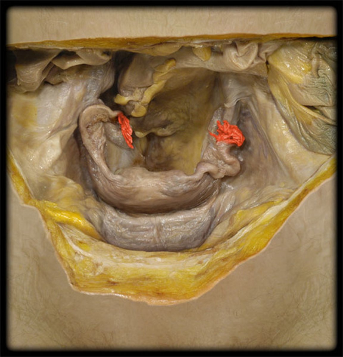 <p>finger-like projection at the free end of the oviduct</p>